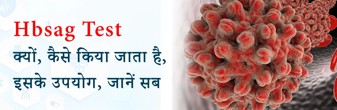 Hbsag Test: क्यों, कैसे किया जाता है, इसके उपयोग, जानें सब